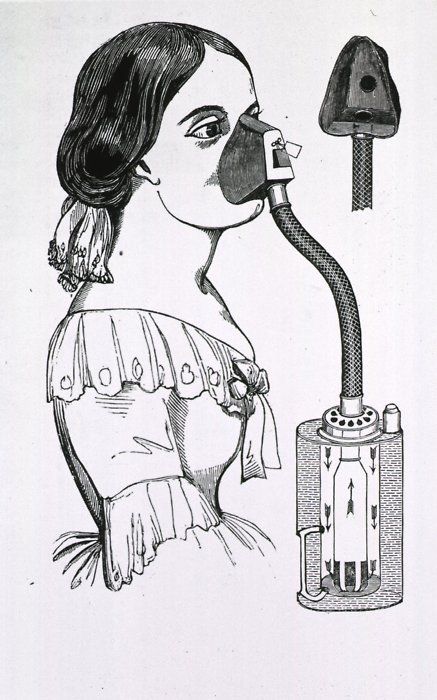При родах в XIX веке вдыхали хлороформ для наркоза. | Фото: costumecocktail.com.