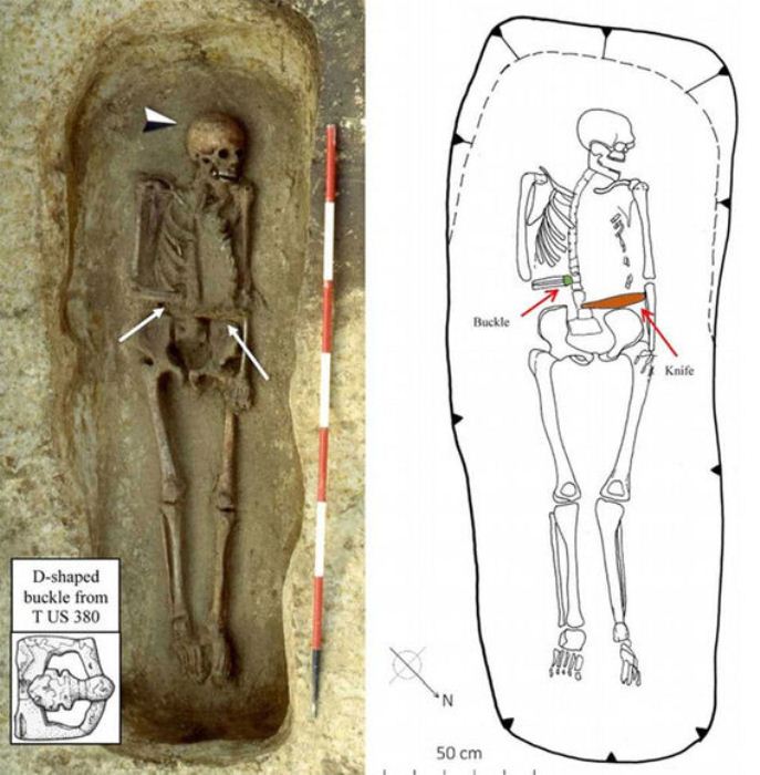 Скелет мужчины с протезом-ножом, обнаруженный археологами.