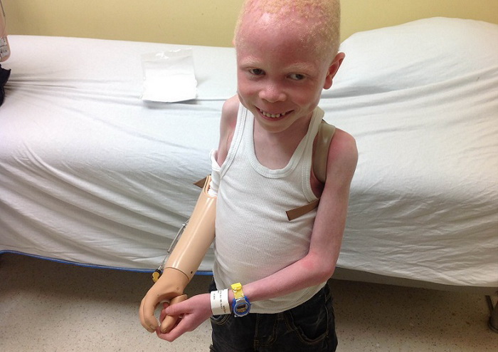 Отец и брат отрезали руку 6-летнему мальчику