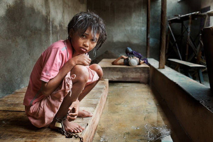 Жуткие условия жизни в психиатрических лечебницах в Индонезии