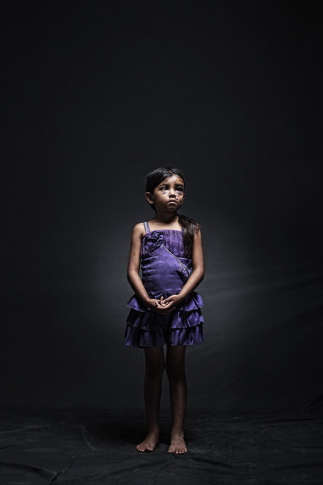 8-летняя Дженифер из Гватемалы незаконно пересекала границу со своей 12-летней сестрой и еще 11 мигрантами. Их грузовик попал в аварию