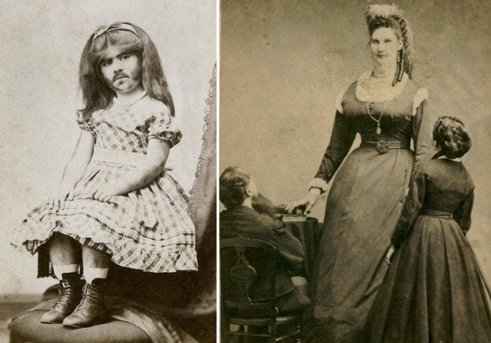 Женщины-циркачки, выступавшие в XIX веке.