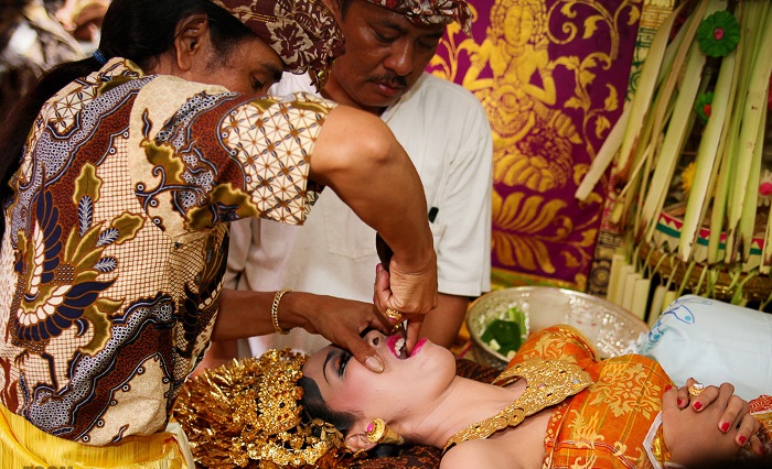 Традиция стачивания зубов на Бали. | Фото: balibudgethousing.com.