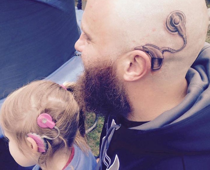 Чтобы поддержать своего ребенка, отец сделал татуировку в виде слухового импланта.