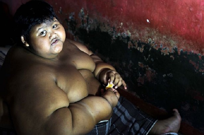 Самый толстый мальчик в мире ест по пять раз в день.