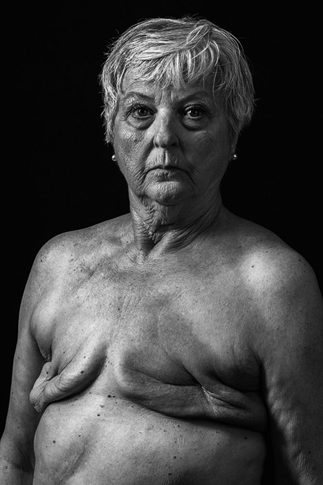 «Breast Cancer». Фото: Huey Kidd.