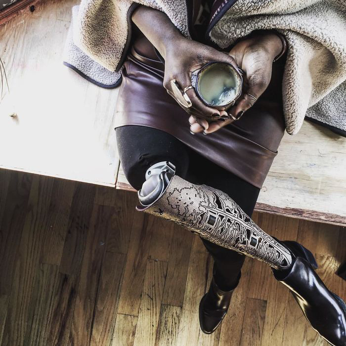 В результате экспериментального лечения девушке удалось победить рак, но ей пришлось ампутировать правую ногу. Instagram caxmee.