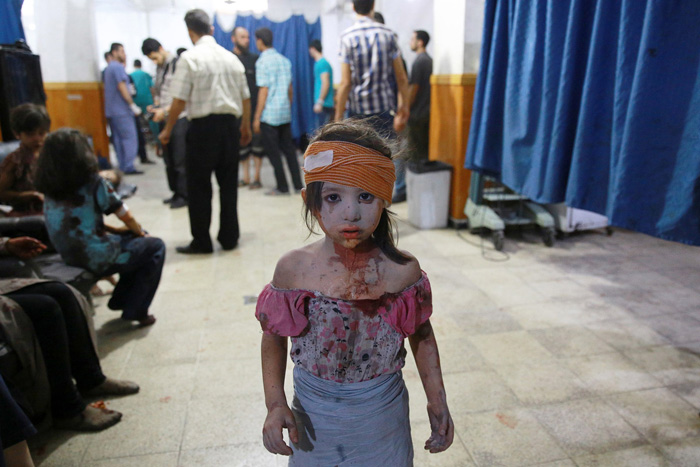 Раненая девочка в больнице города Дума, к востоку от Дамаска, после авиационной атаки 22 августа 2015г.