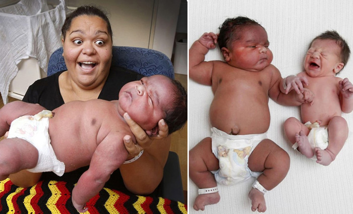 В Мельбурне родился ребенок весом в 6 кг.
