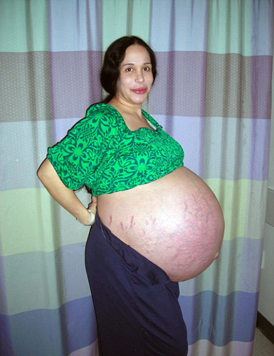 Натали беременна восьмерняшками.
