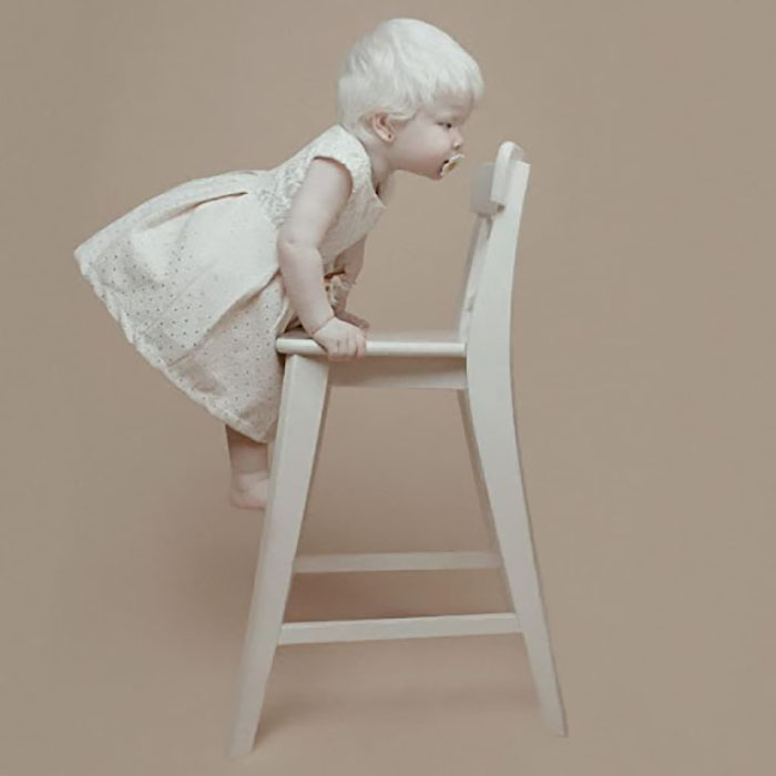 Как оказалось, в семье Айман рождались альбиносы.