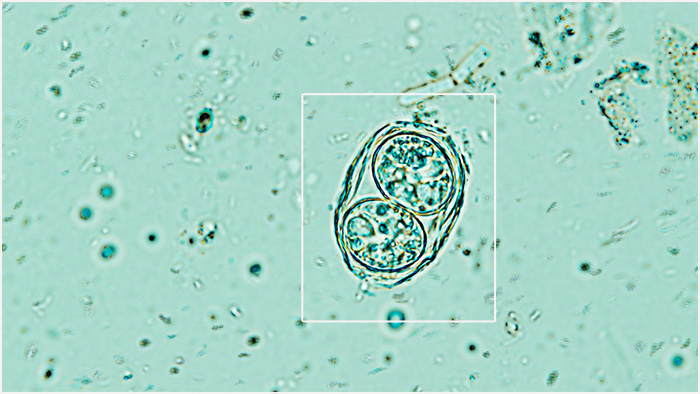 Прочные ооцисты паразита Toxoplasma gondii — яйца, легко перемещаются в пресной воде и открытом океане.