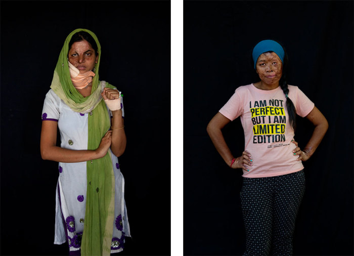 Портреты женщин, чьи лица были изуродованы кислотой.  Автор фото: Ann-Christine Woehrl.