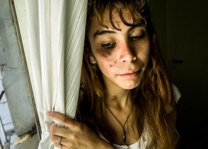 Шестнадцатилетняя К. смотрит в окно после жестокой драки на улице. Автор: Karl Mancini.