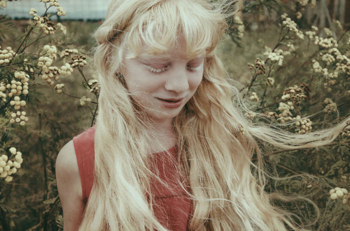 Девочка-альбинос. Автор фото: Мишель де Роса (Michelle de Rose).