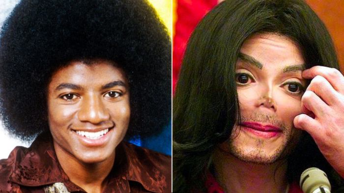 До и после: Майкл Джексон.