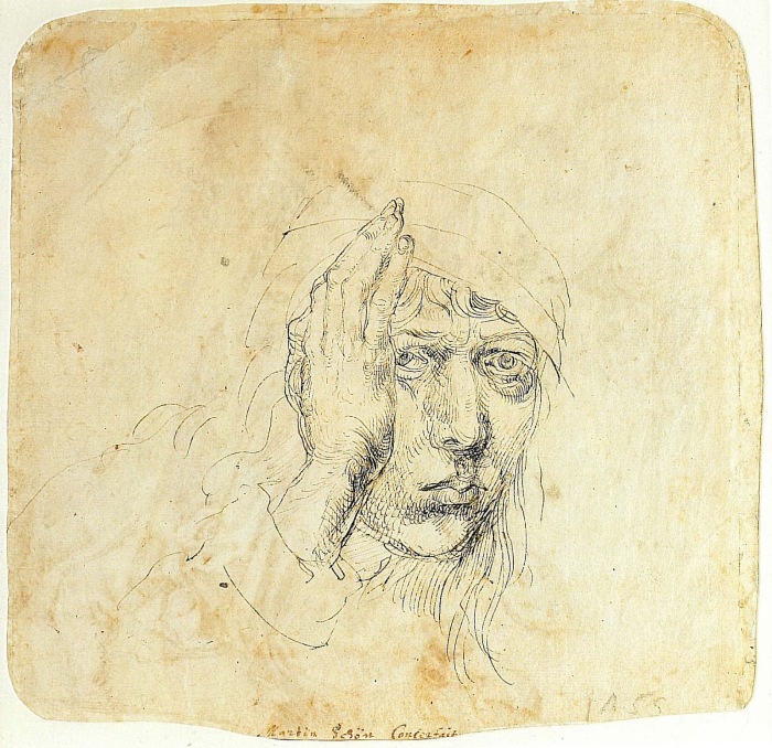 Автопортрет с бинтом, Альбрехт Дюрер, 1492 год. \ Фото: blogspot.com.