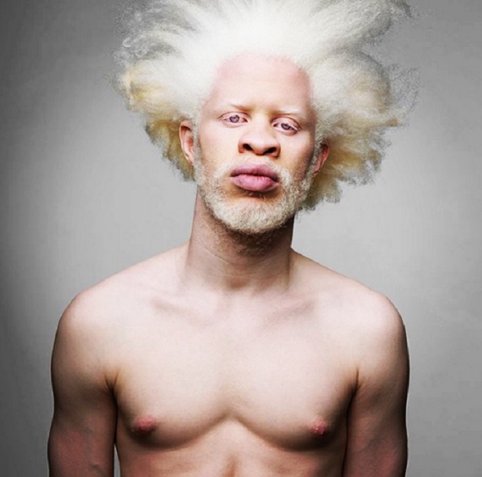 Модель-альбинос.