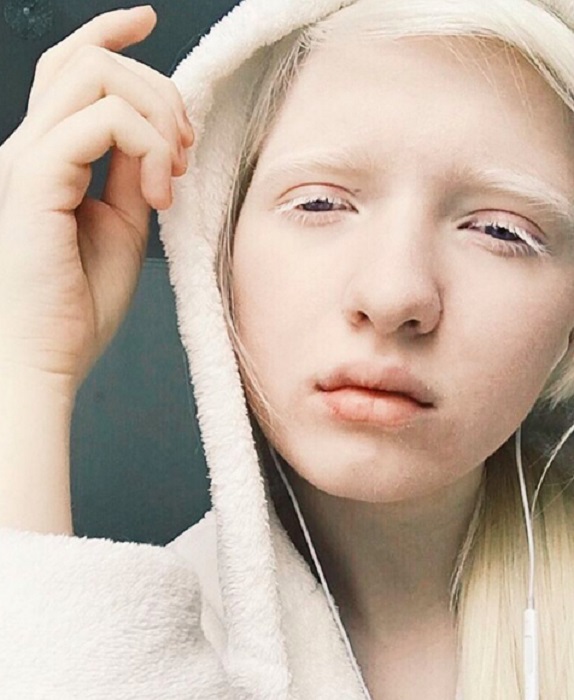 Молодая русская модель-альбинос с очень интересной внешностью.
