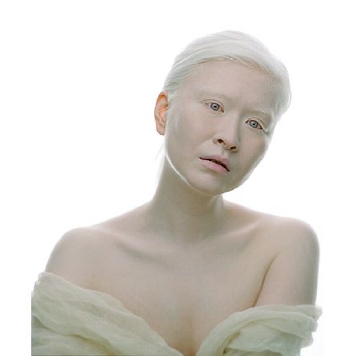 Китаянка Конни стала первой девушкой с альбинизмом, которую признала модная индустрия.