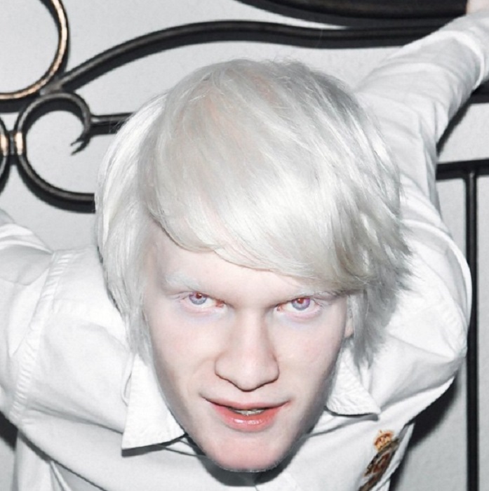 Амаль начинающий модель-альбинос.