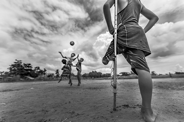 Похвальные отзывы за снимок получил фотограф Зарни Мио Вин (Zarni Myo Win) из Мьянмы, который запечатлел одноногого мальчика, наблюдающего за игрой в футбол.