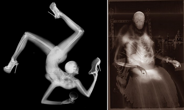 Картины из рентген-аппарата. Нестандартное творчество Бенедетты Боничи (Benedetta Bonichi)
