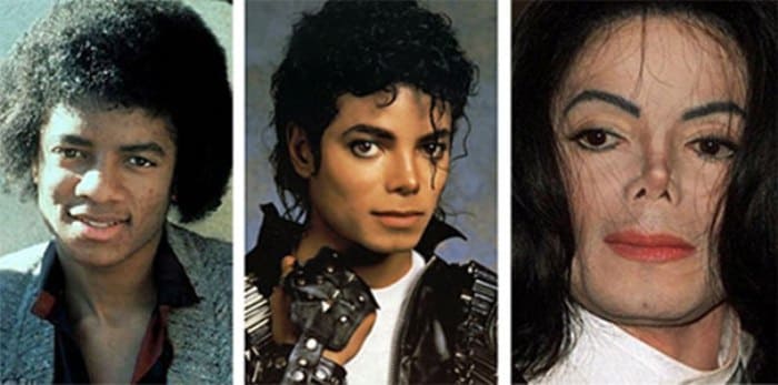 Так внешность Майкла Джексона менялась с годами | Фото: sfw.so