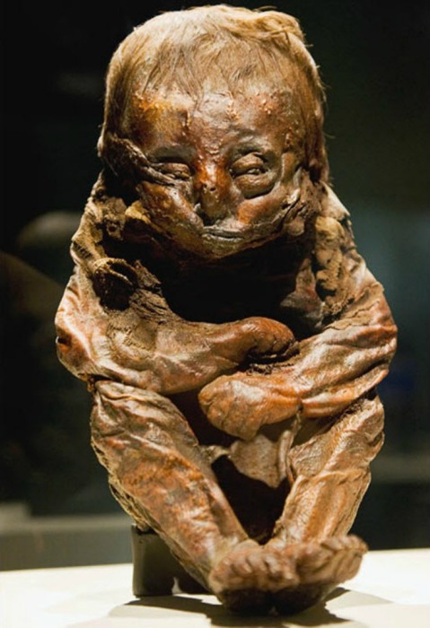  Мумия перуанского 8-10-месячного ребенка, скончавшегося 6500 лет назад, скорее всего, от болезни сердца.