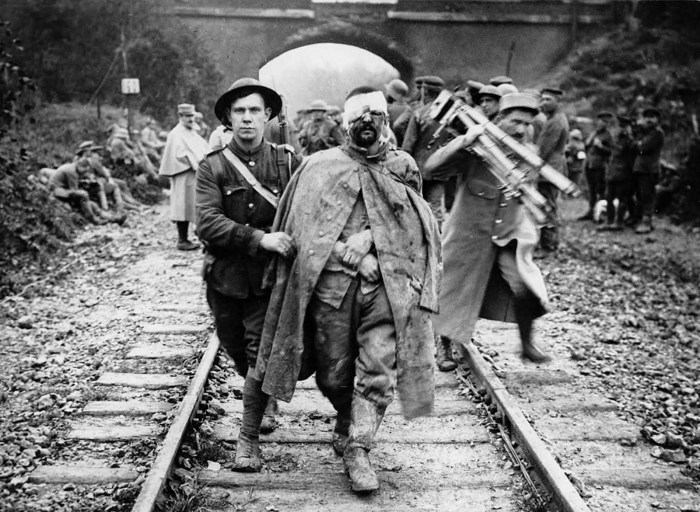 Раненый и грязный немецкий военнопленный.