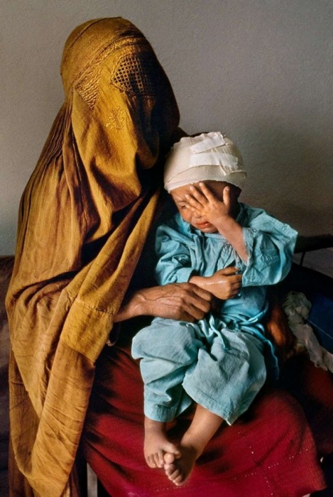 Женщина с сыном, который получил осколочные ранения. Афганистан, 1992 год.