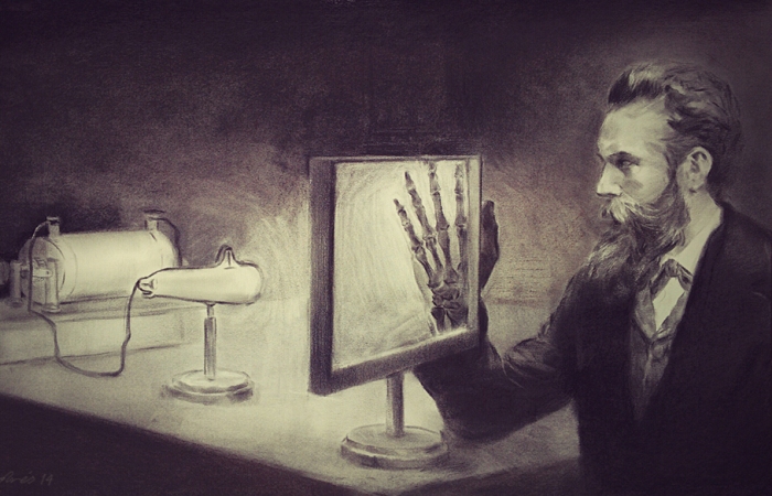 Вильгельм Рентген просвечивает руку. | Фото: araceliregolodos.blogspot.com.