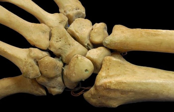 Торговля  человеческими скелетами: «плохие британские кости».