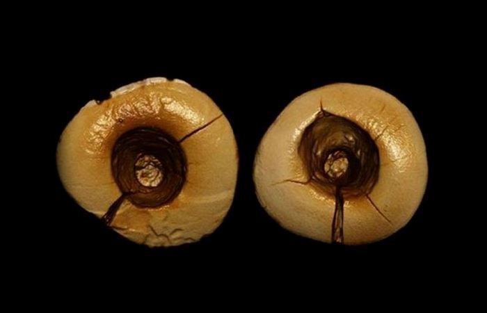 Каменный век: стоматологические процедуры.