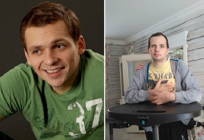 Янин инсульт фото до и после