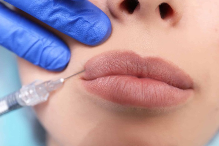 Косметология позволяет сделать губы такими, какие пожелаешь.  /Фото: woman-cosmetolog.com