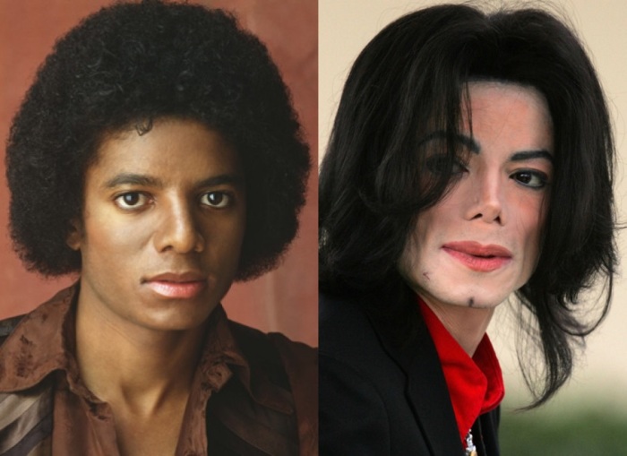 Майкл Джексон перенес, как минимум, две операции по изменению носа, и в последние годы с этой частью лица у него было не все в порядке. /Фото::300experts.ru
