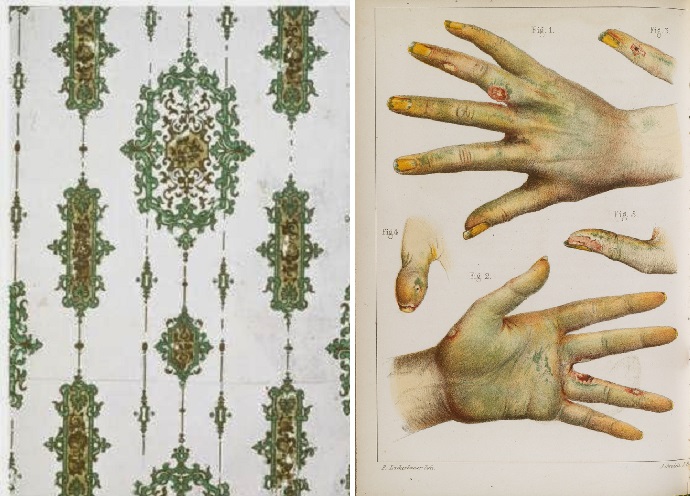 Старинная картинка демонстрирует, как парижская зелень (например, на обоях) влияет на кожу.