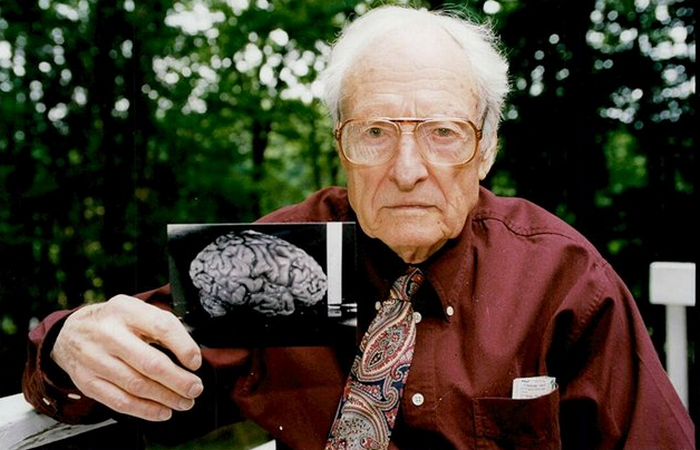 Перед своей смертью Томас Харви завещал кусочки мозга гения музею. / Фото:Яндекс.Дзен