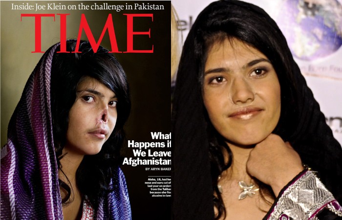 Биби Айша — юная афганская девушка, жестоко искалеченная мужем.