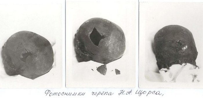 Экспертам удалось увидеть в какое место черепа вошла на самом деле пуля. /Фото:www.istpravda.com.ua