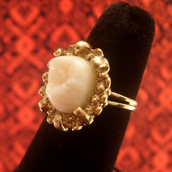 Оригинальные украшения: кольцо с человеческим зубом